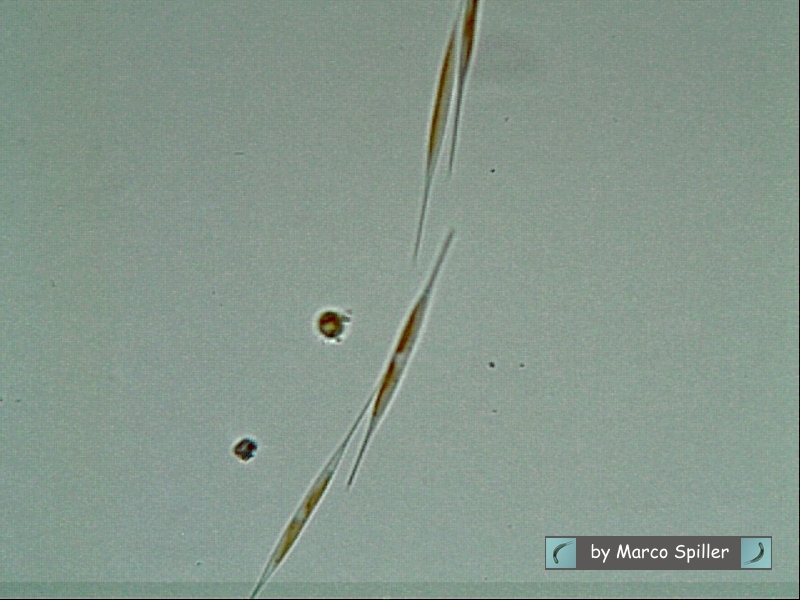 Nitzschia acicularis in fila indiana